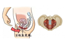 了解盆底肌，才知道它有多重要！